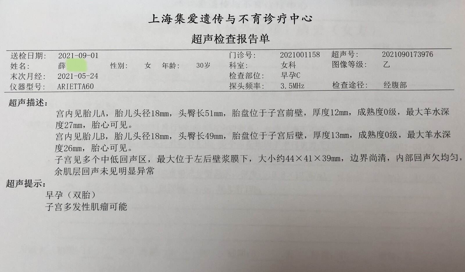 夫夫试管婴儿(老婆孩子热炕头语录)