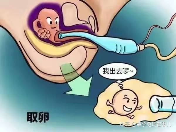 试管婴儿的形成(试管婴儿的具体步骤)