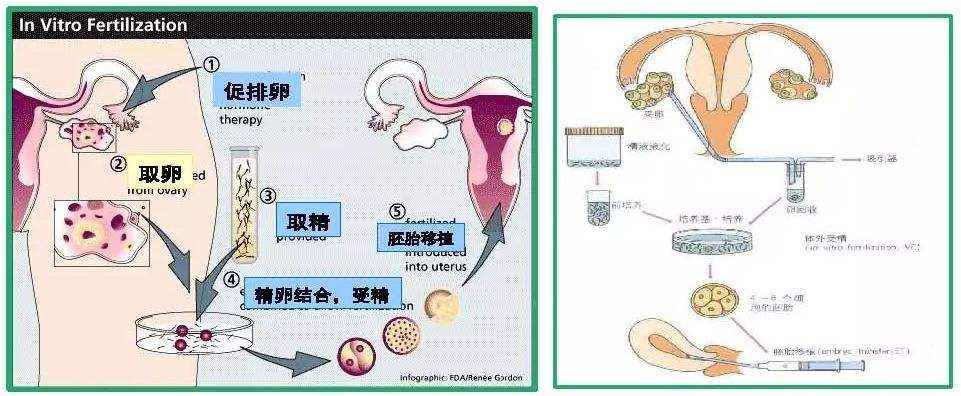 试管婴儿哪些利弊(千万不要做试管婴儿)