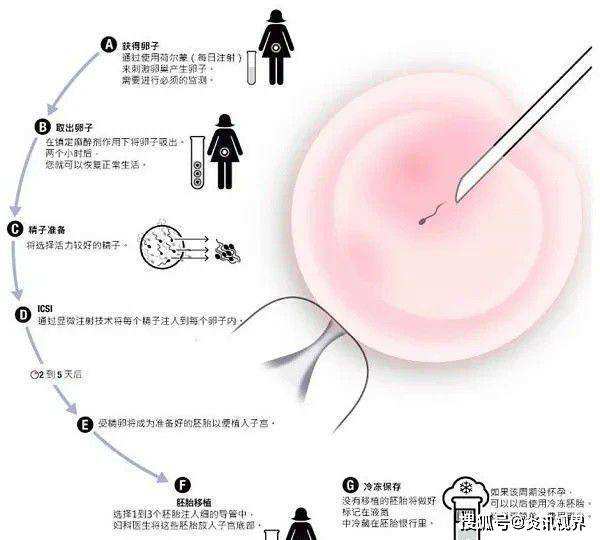 试管婴儿生殖方式试管婴儿是有性繁殖吗