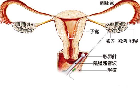 医院结婚证试管婴儿(医院要结婚证能查出来吗)